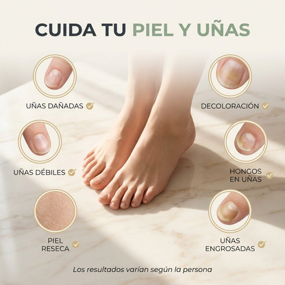 Sérum Antihongos para Uñas
