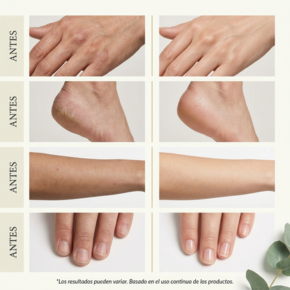 Sérum Antihongos para Uñas